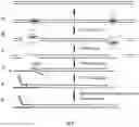 Fig. 06 - Method of nucleic acid enrichment using site-specific nucleases followed by capture