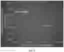 Fig. 23 - COST-EFFECTIVE DETECTION OF LOW FREQUENCY GENETIC VARIATION