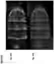 Fig. 17 - METHOD TO GENERATE BIOCOMPATIBLE DENDRITIC POLYMERS FOR ANALYTE DETECTION WITH MULTIMODAL LABELING AND SIGNAL AMPLIFICATION