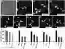 Fig. 01 - RETINAL GANGLION CELL SUBTYPE DIFFERENTIATION FROM HUMAN PLURIPOTENT STEM CELLS