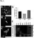 Fig. 04 - RETINAL GANGLION CELL SUBTYPE DIFFERENTIATION FROM HUMAN PLURIPOTENT STEM CELLS
