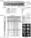 Fig. 05 - KIT FOR EARLY SCREENING OF LIVER CELL CANCER AND PREPARATION METHOD AND USE THEREOF