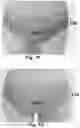 Fig. 05 - Underwear, and System and Method of Producing Underwear