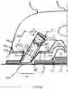 Fig. 33 - Portable textile treatment device with image sensor and thermal insulation means