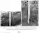 Fig. 03 - Slope repair method
