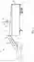 Fig. 02 - Telescopic ladder system for a vehicle, and safety system and method for securing an operator atop a vehicle or van