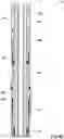 Fig. 24 - Method and system for boosting sealing elements of downhole barriers