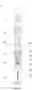 Fig. 07 - Check valve, associated downhole data collection system and inner core