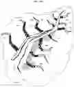 Fig. 08 - Methods and systems for treating hydraulically fractured formations