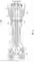 Fig. 12 - Compact axial turbine for high density working fluid