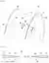 Fig. 04 - REPAIRING OR RESUMING PRODUCTION OF A COMPONENT MADE OF COMPOSITE MATERIAL