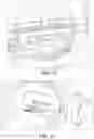Fig. 06 - Throttle body with fluid flow control