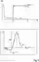 Fig. 04 - Method for ascertaining a variable characterizing a flow rate of a fuel injector
