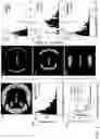 Fig. 08 - Suction discs for adhesion to rough, delicate, and wet surfaces