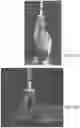 Fig. 14 - Suction discs for adhesion to rough, delicate, and wet surfaces