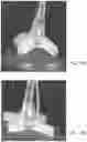 Fig. 17 - Suction discs for adhesion to rough, delicate, and wet surfaces