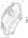 Fig. 06 - Caliper body and brake caliper with said body