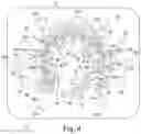 Fig. 05 - Microvalve, and a multi-directional valve apparatus