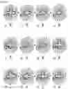 Fig. 15 - Method and system for estimating convergence of changes in dimensions of molded article over time