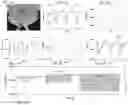 Fig. 14 - SCALABLE AND HIGH-PERFORMANCE PRESSURE SENSORS FOR WEARABLE ELECTRONICS