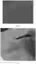 Fig. 06 - SENSOR