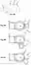 Fig. 08 - Optical pressure measurement devices, methods, and systems