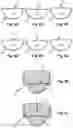 Fig. 09 - Optical pressure measurement devices, methods, and systems