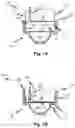 Fig. 10 - Optical pressure measurement devices, methods, and systems