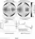 Fig. 09 - Deflectometry devices, systems and methods