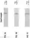 Fig. 02 - Method for detection and interpretation of results indicated on a photographed diagnostic test