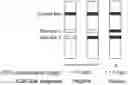 Fig. 01 - Semi-quantitative lateral-flow immunoassay for the detection of CSF leaks