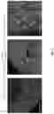 Fig. 02 - RENAL CLEARABLE NANOPARTICLES AS EXOGENOUS MARKERS FOR EVALUATING KIDNEY FUNCTION