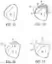 Fig. 07 - Prosthodontic and orthodontic apparatus and methods