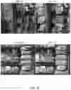 Fig. 31 - Accelerated Learning In Neural Networks Incorporating Quantum Unitary Noise And Quantum Stochastic Rounding Using Silicon Based Quantum Dot Arrays