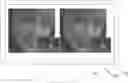 Fig. 01 - Systems and methods for compression artifact detection and remediation