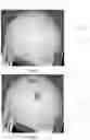 Fig. 17 - System and method for extracting and measuring shapes of objects having curved surfaces with a vision system