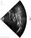 Fig. 08 - Robust segmentation through high-level image understanding