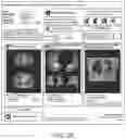 Fig. 04 - Systems and methods for assessing a likelihood of CTEPH and identifying characteristics indicative thereof