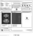 Fig. 06 - Systems and methods for assessing a likelihood of CTEPH and identifying characteristics indicative thereof