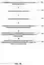 Fig. 19 - Pre-morbid characterization of anatomical object using statistical shape modeling (SSM)