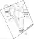 Fig. 01 - Pre-morbid characterization of anatomical object using statistical shape modeling (SSM)