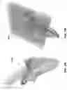 Fig. 08 - Pre-morbid characterization of anatomical object using statistical shape modeling (SSM)