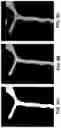 Fig. 09 - Pre-morbid characterization of anatomical object using statistical shape modeling (SSM)