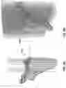 Fig. 10 - Pre-morbid characterization of anatomical object using statistical shape modeling (SSM)