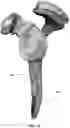 Fig. 14 - Pre-morbid characterization of anatomical object using statistical shape modeling (SSM)