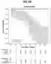 Fig. 12 - ARTIFICIAL INTELLIGENCE PREDICTION OF PROSTATE CANCER OUTCOMES