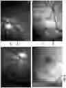 Fig. 07 - Spectral-spatial imaging device
