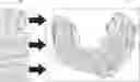 Fig. 01 - Intraoral scanning system with excess material removal based on machine learning