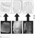 Fig. 11 - Intraoral scanning system with excess material removal based on machine learning