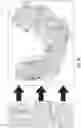 Fig. 12 - Intraoral scanning system with excess material removal based on machine learning